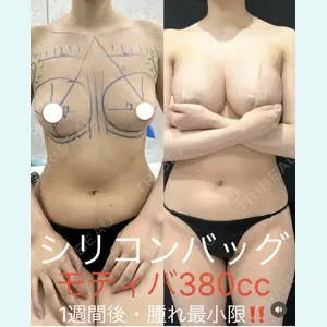 症例