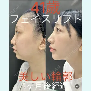 症例
