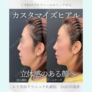 症例