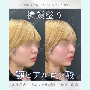 症例