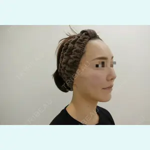 ユウコ形成外科クリニック 植田　有子医師の症例