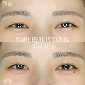Mare beauty clinic 前波　希映医師の症例