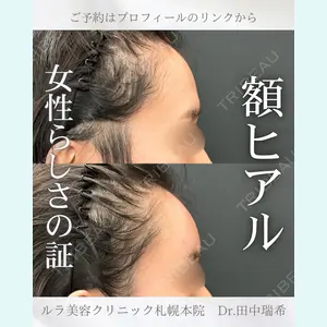 症例