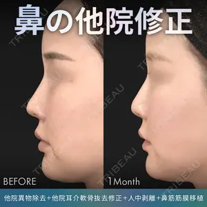 症例