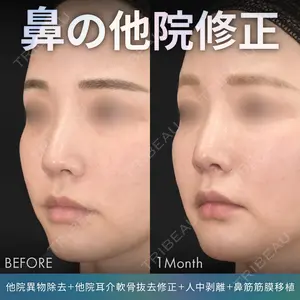 症例