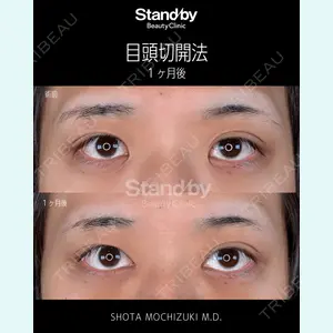 症例