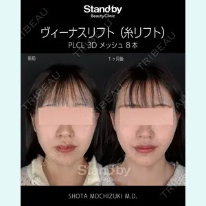 症例
