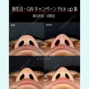 症例