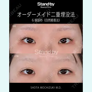 症例