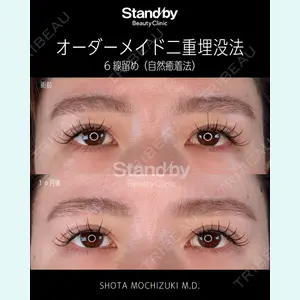 症例