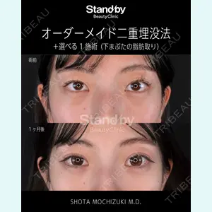 症例