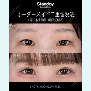 症例