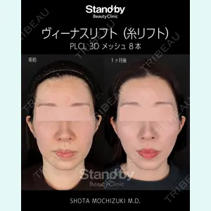 症例