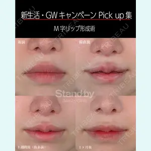 症例