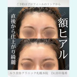 症例