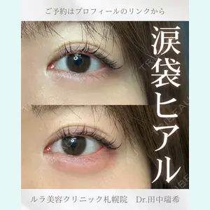 症例