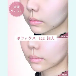 症例