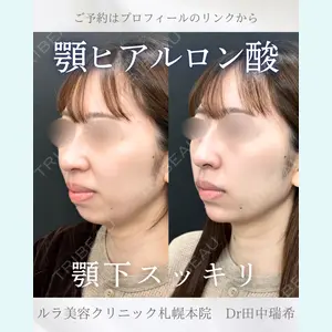 症例