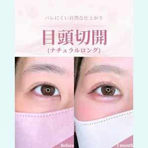 症例