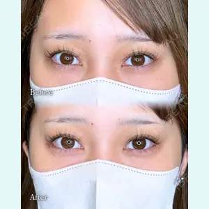 症例