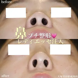 症例