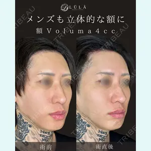 症例