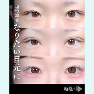 症例