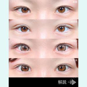 症例