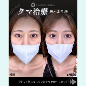 症例