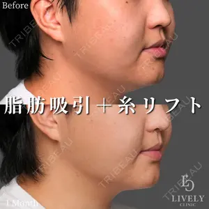 症例