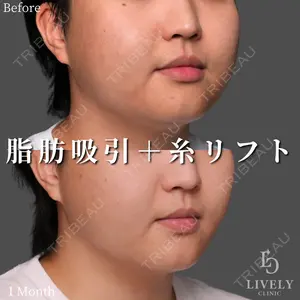 症例