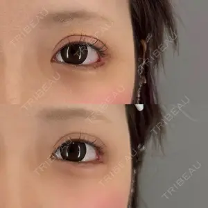 症例