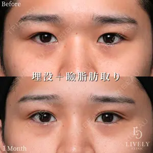 症例