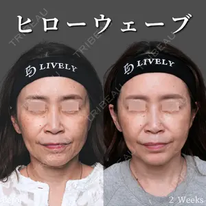 症例