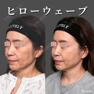 症例