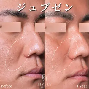 症例