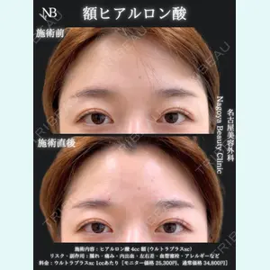 症例