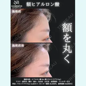 症例