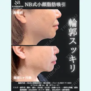症例