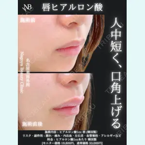 症例