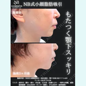 症例