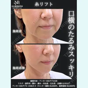 症例
