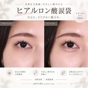 症例