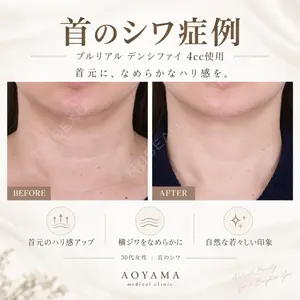 症例