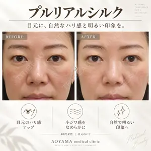 症例