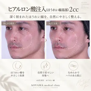 症例