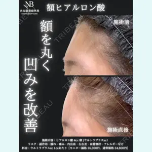 症例
