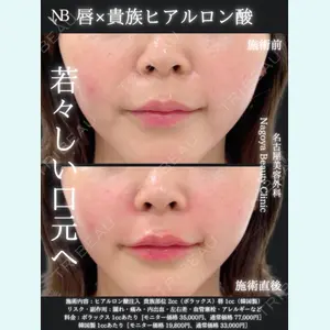 症例