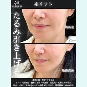 症例