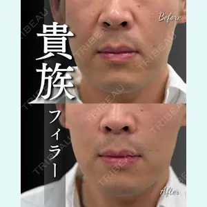 症例